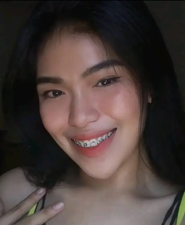 ************* Fernandez (Chinita With Braces) | Solid Set
