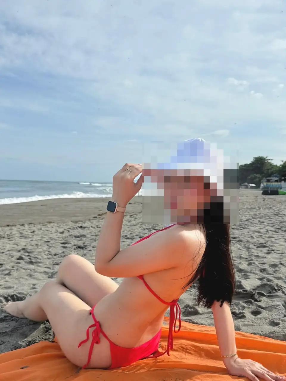 1000006173_anonymized.webp