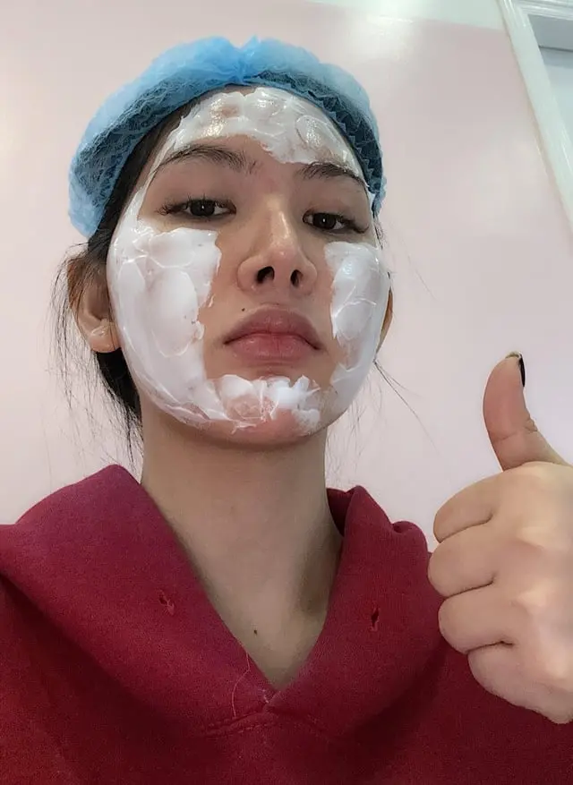 had-my-skin-treatment-yesterday-lol-v0-r04tb0cbf3od1.webp