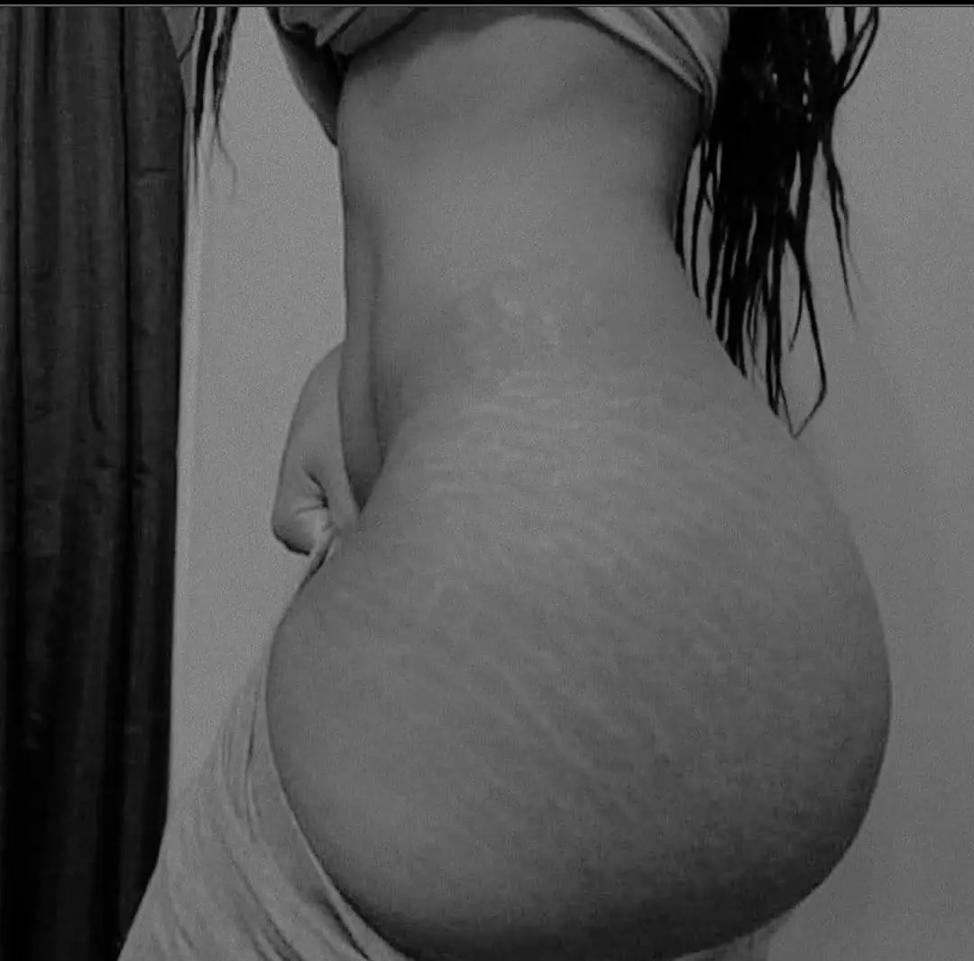 What's your Thought Masarap ba dilaan pag ganto stretch mark