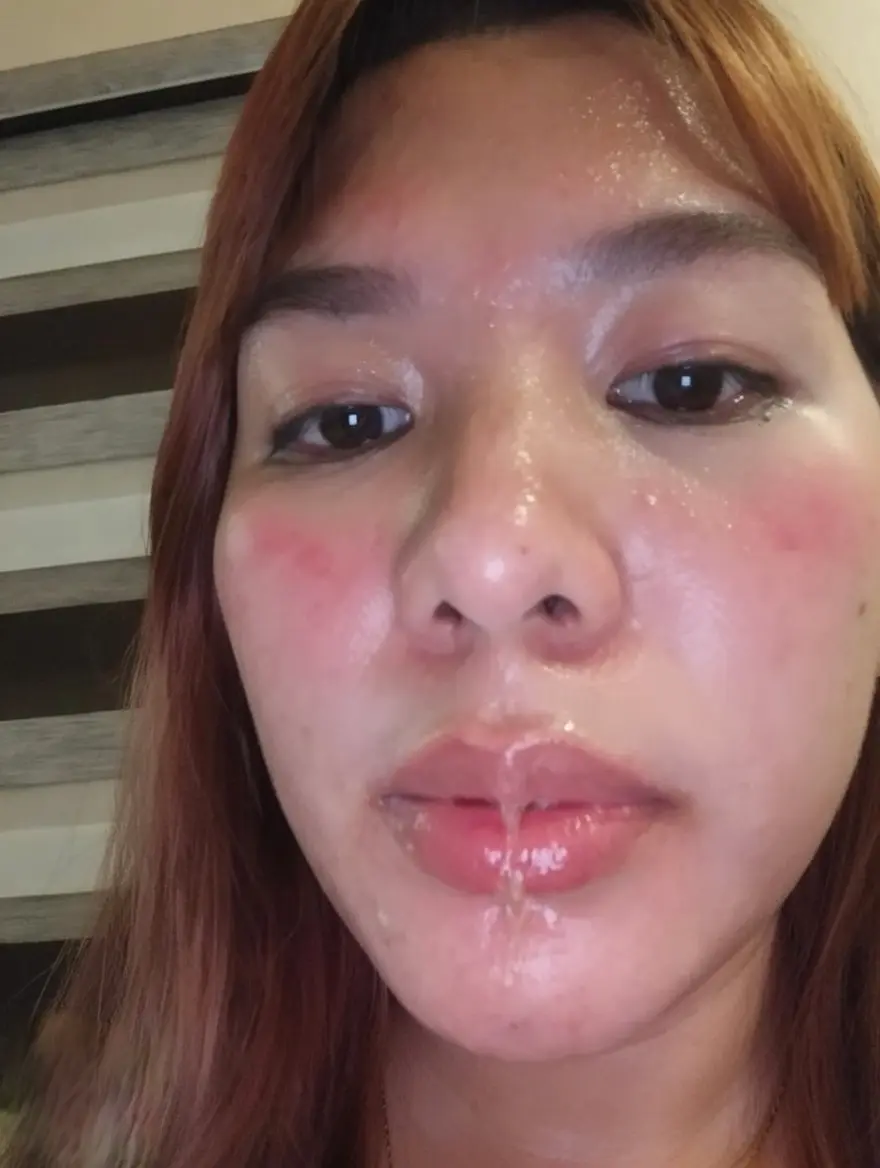 After chupa pic ni misis