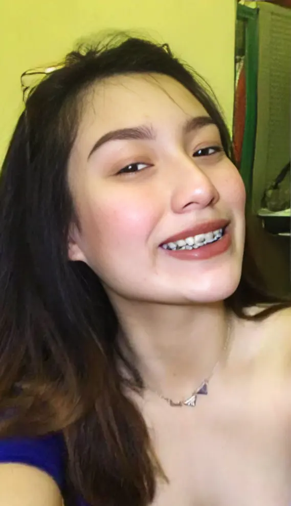 Altrina | Full Set | No Watermarks
